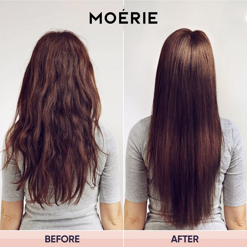Moerie Ultimate Hair Growth Spray | bodytonix Australia | bodytonix